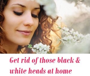 black heads and white heads naturally