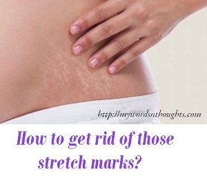 How to get rid of those stretch marks