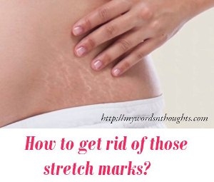 get rid of those stretch marks