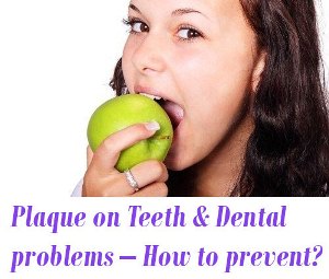 Plaque on Teeth and Dental problems